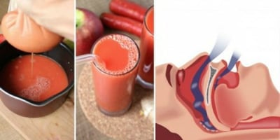 Remède Naturel pour Lutter Contre les Ronflements et Éviter L’apnée du Sommeil Remède Naturel pour Lutter Contre les Ronflements et Éviter L’apnée du Sommeil