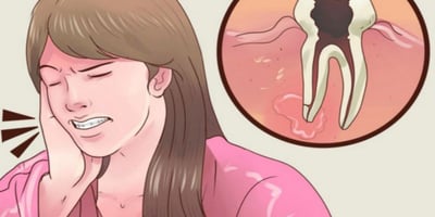 Rincez votre Bouche Pendant 1 Minute avec CECI et Éliminer le Tartre et les Plaque de vos Dents