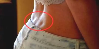 Si vous Avez ces Deux Trous sur le Dos, c’est que vous Êtes une Personne Spéciale ! Si vous Avez ces Deux Trous sur le Dos, c’est que vous Êtes une Personne Spéciale !