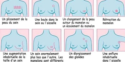 Signes Visibles et Cachés de Cancer du Sein
