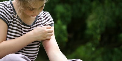 Stoppez la Démangeaison Causé par un Moustique