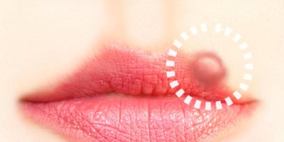 Trucs et Astuces pour Combattre les Feux Sauvages!