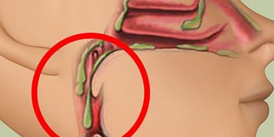 Un Sirop Puissant pour Calmer la Toux et Éliminer le Mucus des Poumons… Un Sirop Puissant pour Calmer la Toux et Éliminer le Mucus des Poumons…