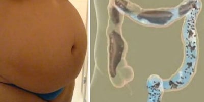Soulager la Constipation et les Ballonnements en Quelques Minutes