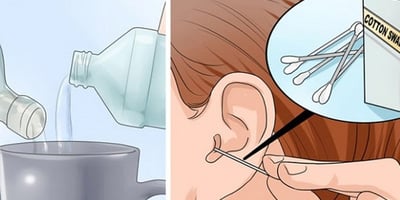 Voici Comment Nettoyer vos Oreilles du Cérumen en Moins de 60 Secondes