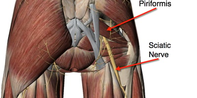 Voici Comment Soulager les Douleurs d'une Sciatique en 1 Seule Minute!