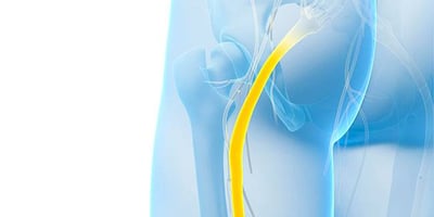 Voici Comment Soulager sa Sciatique Naturellement