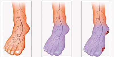 Vous Souffrez d’une Mauvaise Circulation ? Voici Comment y Remédier en Seulement 20 Minutes