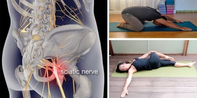 8 Postures de Yoga pour Soulager la Douleur Sciatique