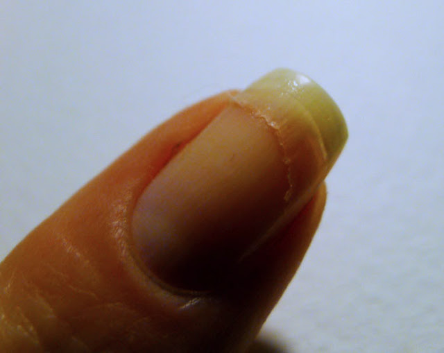 Réparer un Ongle Cassé avec un Sachet de Thé