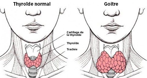 Comment un Mauvais Transit Intestinal peut Provoquer un Dérèglement de la Thyroïde