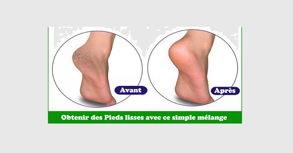 Comment obtenir des Pieds Lisses