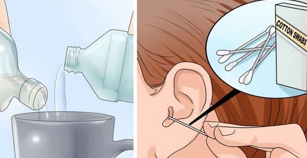 Éliminer le Cérumen et les Infections de L’oreille avec ces Deux Ingrédients