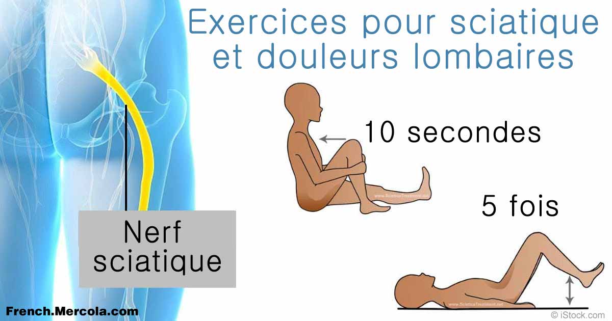Exercices pour la Sciatique