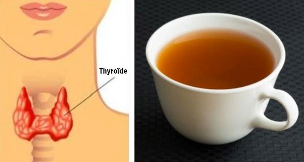 La Meilleure Façon de Perdre du Poids, si vous Avez un Trouble de la Thyroïde